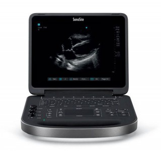 УЗИ аппарат FUJIFILM SonoSite Edge II